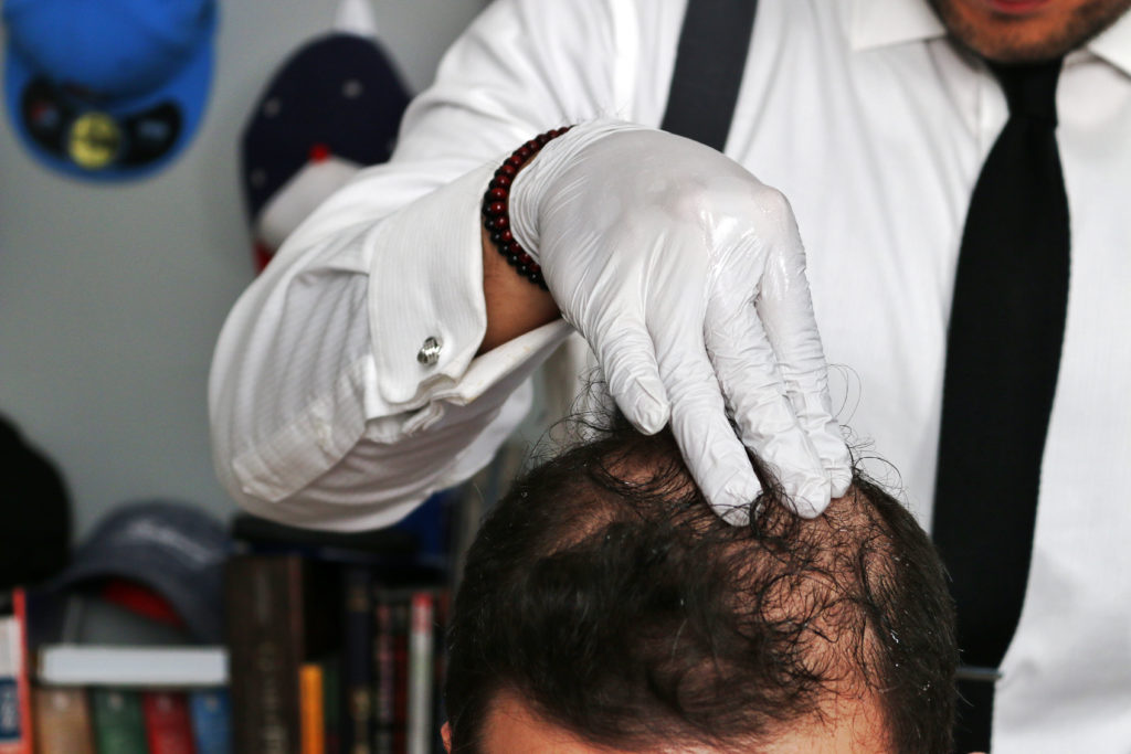 Minoxidil 毛髮專+ 洗頭 | 髮型 | 脫髮 | 植髮