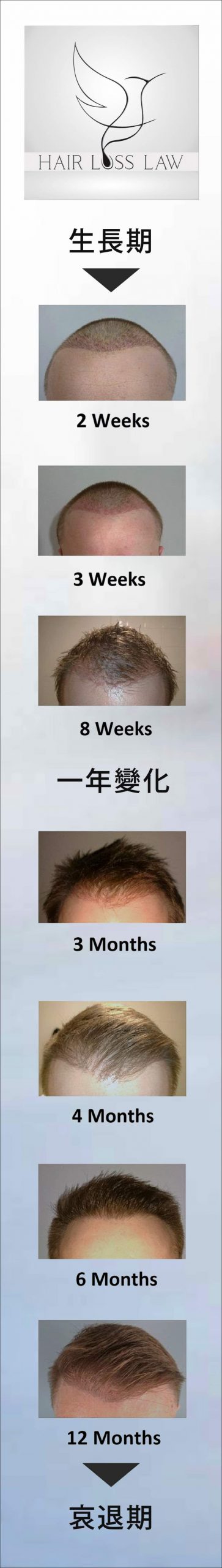hair-growth-cycle 頭髮生長期 毛髮專+ 洗頭 | 髮型 | 脫髮 | 植髮