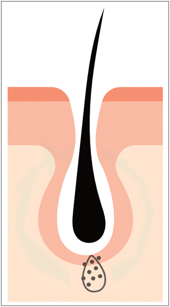 hairlosslaw_growth 頭髮 毛髮專+ 洗頭 | 髮型 | 脫髮 | 植髮