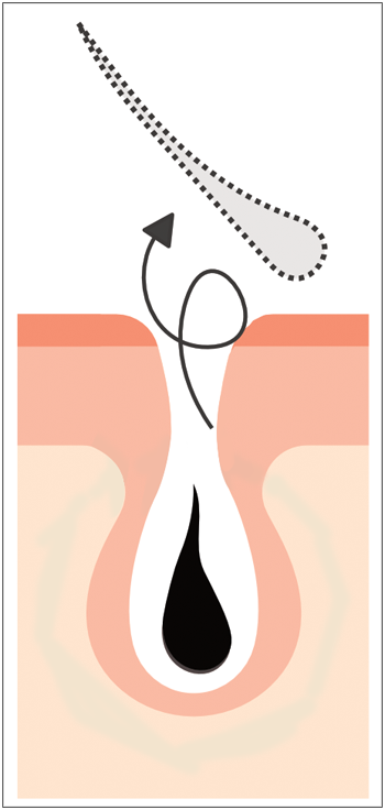 hairlosslaw_growth 頭髮 毛髮專+ 洗頭 | 髮型 | 脫髮 | 植髮